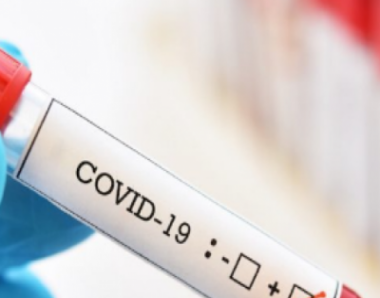 TUDO SOBRE OS TESTES PARA CORONAVIRUS - COVID-19