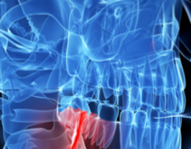 CIRURGIA BUCO MAXILO FACIAL - SJC